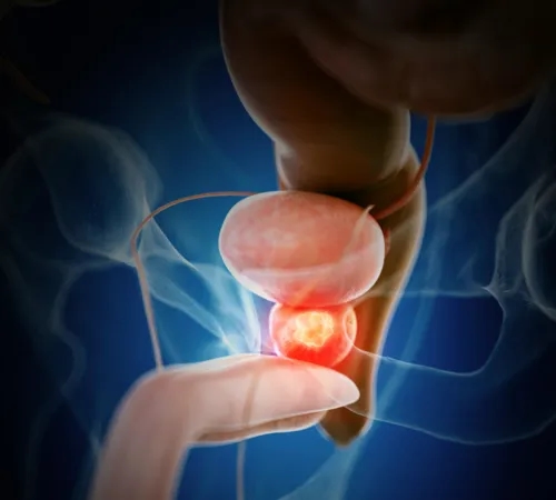 Objawy prostaty u mężczyzny: Nie ignoruj tych niepokojących sygnałów