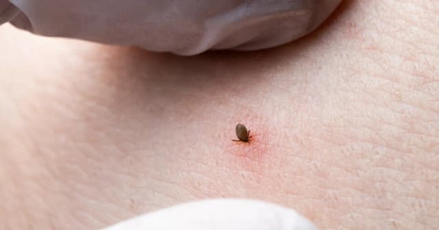 Kleszcz – kiedy do lekarza? Objawy, które mogą zagrażać zdrowiu Kleszcz – kiedy do lekarza? Objawy, które mogą zagrażać zdrowiu