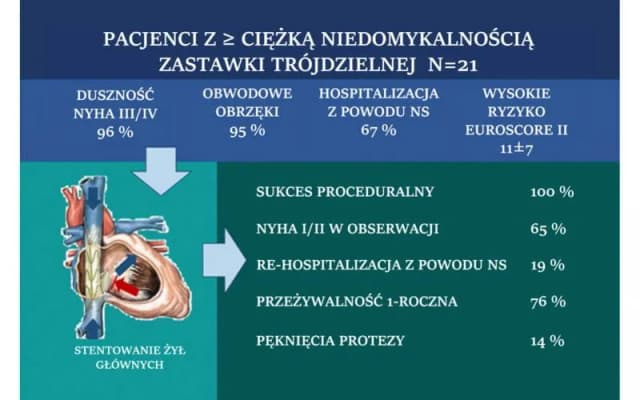 Niedomykalność zastawki objawy: jak je rozpoznać i co robić? Niedomykalność zastawki objawy: jak je rozpoznać i co robić?