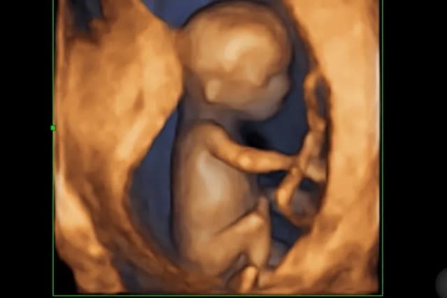 Kiedy zrobić badania prenatalne, aby uniknąć nieprawidłowości? Kiedy zrobić badania prenatalne, aby uniknąć nieprawidłowości?