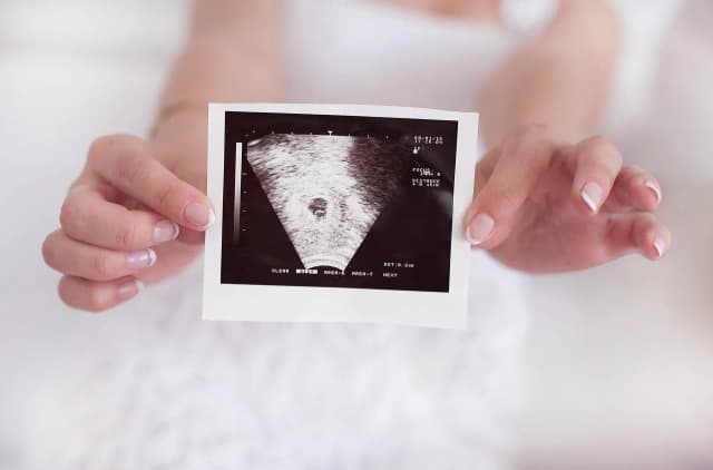 Czy w 5 tygodniu lekarz potwierdzi ciążę? Co warto wiedzieć?